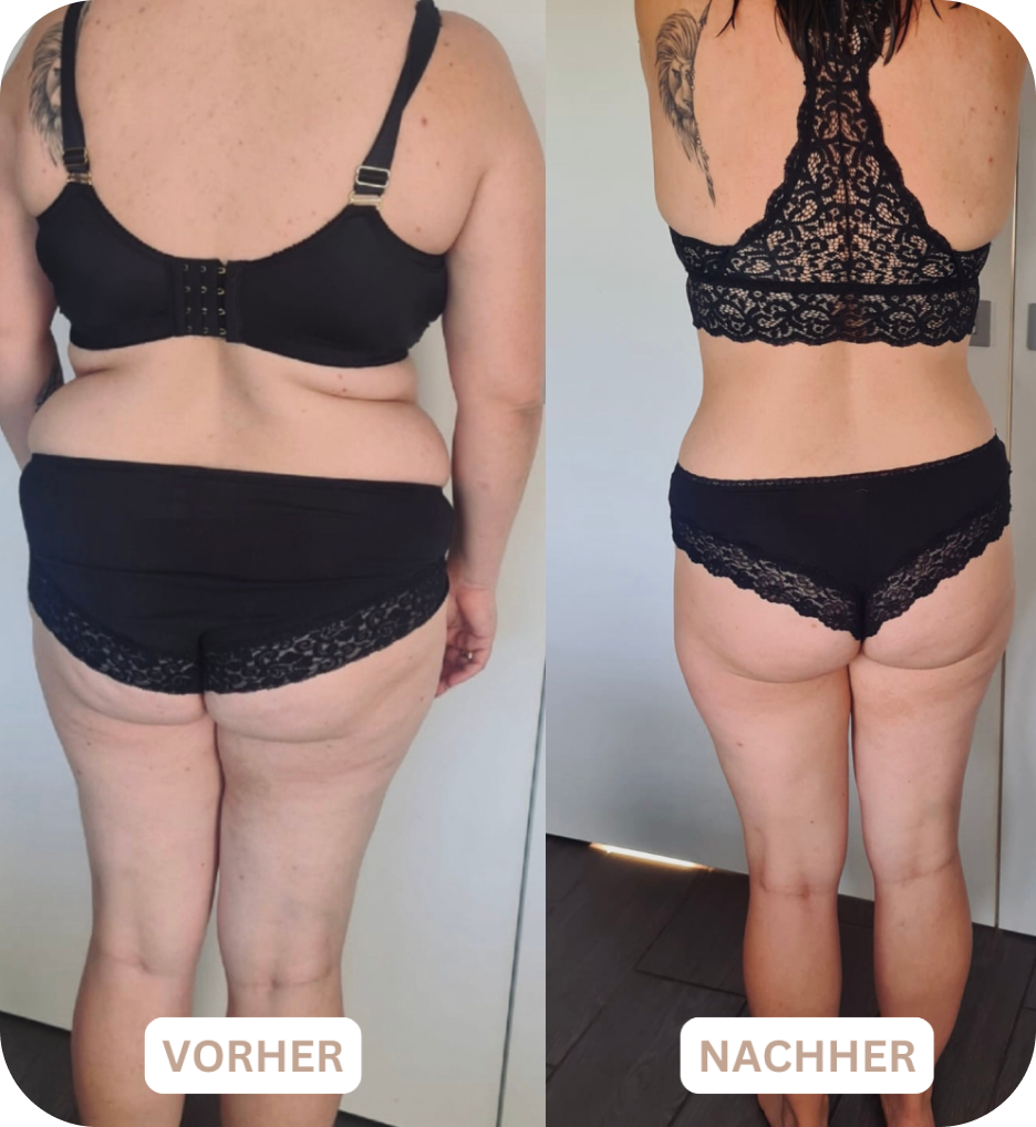 before after